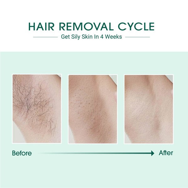 Laser IPL Hair Removal Device with ergonomic design and safety features for at-home use.