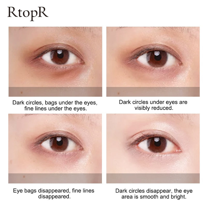 Skin Care Products for Women to Improve Dark Circles and Reduce Fine Lines Around the Eyes Eye Bag Remover Eye Cream 15G