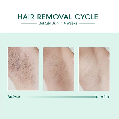 Laser IPL Hair Removal Device with ergonomic design and safety features for at-home use.

